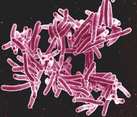 NIH Funds New Tuberculosis Research Advancement Centers